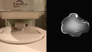 La calidad de un lomo se puede predecir introduciéndolo en un escáner MRI y analizando su imagen de resonancia magnética