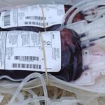 En situación crítica las reservas de sangre de grupos 0+, 0-, A+, A- y B- en los hospitales madrileños