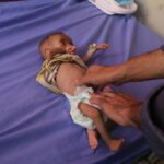 Un bebé con desnutrición en un hospital de la ciudad de Gaza, en medio de la ofensiva del Ejército de Israel contra la Franja de Gaza (archivo). (Foto: Europa Press/Contacto/Omar Ashtawy)