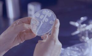 Una de cada seis infecciones bacterianas en 2023 fueron resistentes a antibióticos, según un informe de la OMS. / Unsplash